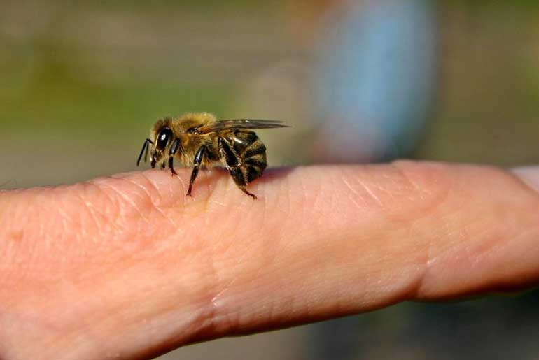درمان خانگی نیش زنبور