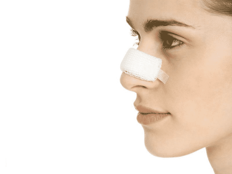چسب زدن بینی بعد از عمل